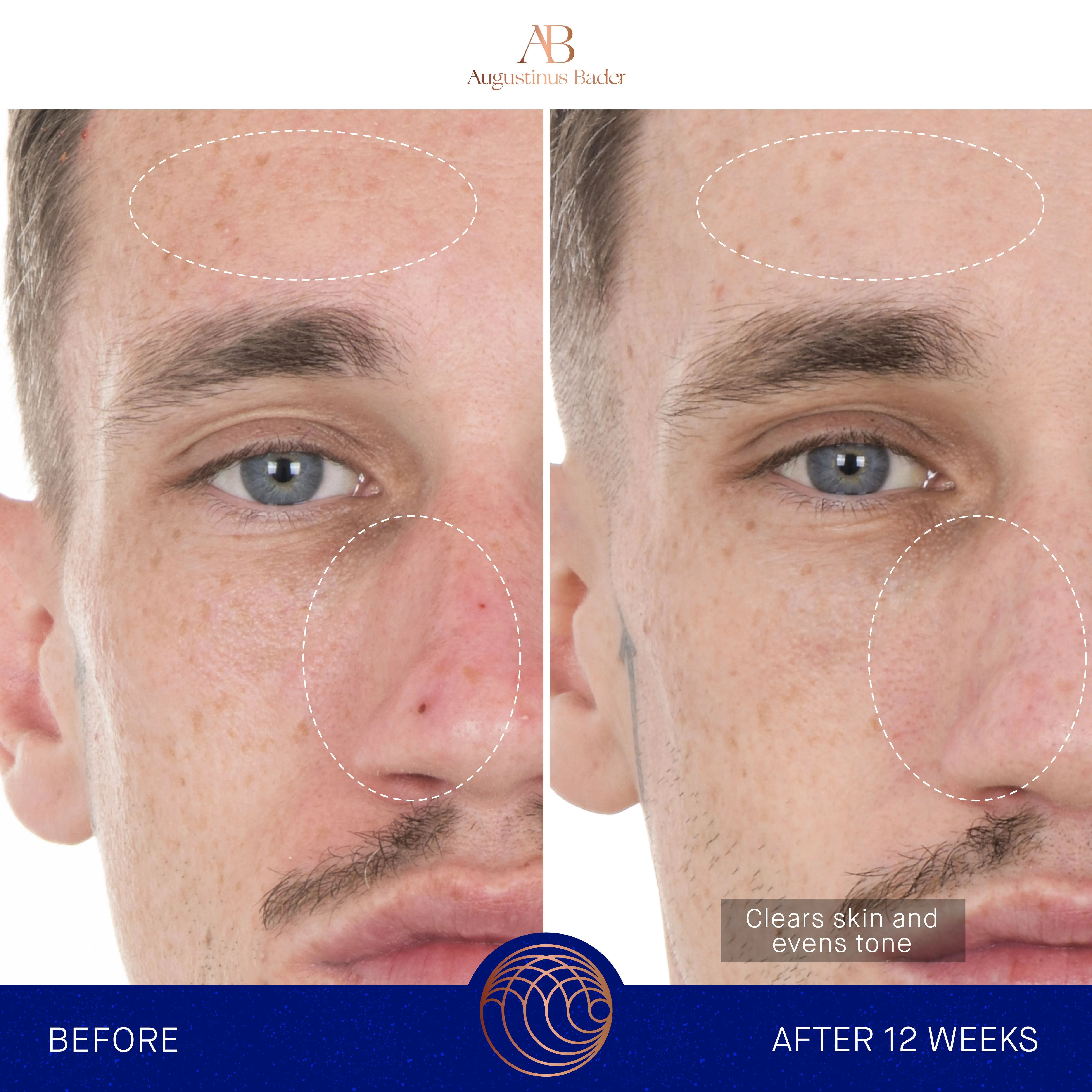The Retinol Serum